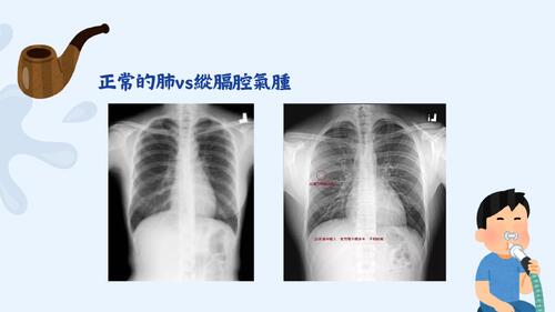 抽的是壓力傷的是自己